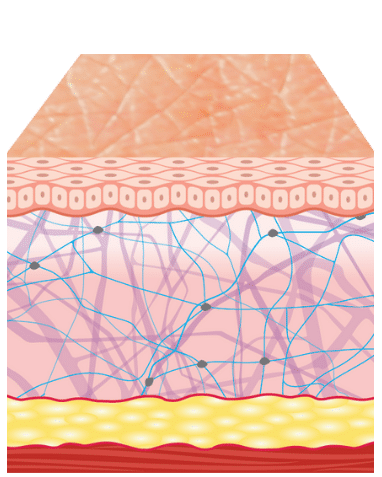 Diagram showing smooth skin appearance